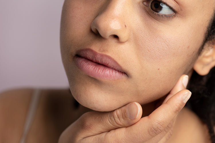 Dry Skin